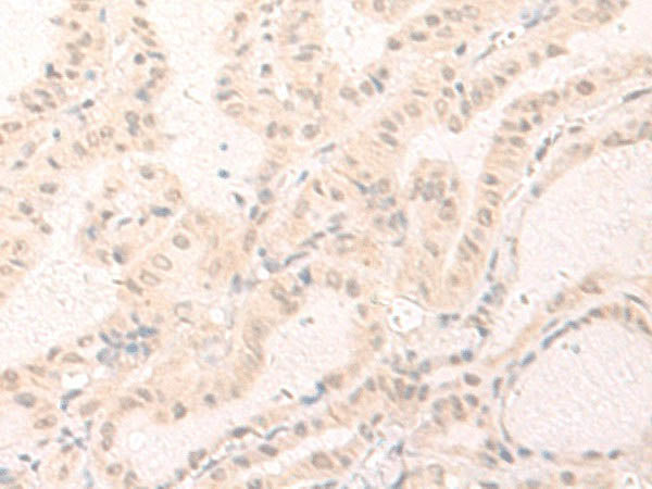 IL7 Polyclonal Antibody