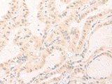 IL7 Polyclonal Antibody