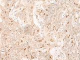 IL7 Polyclonal Antibody