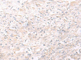 IL26 Polyclonal Antibody