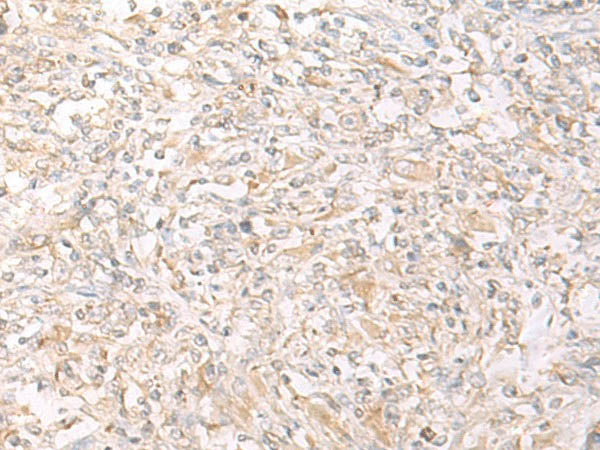 IL12B Polyclonal Antibody