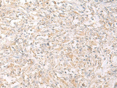 IL12B Polyclonal Antibody