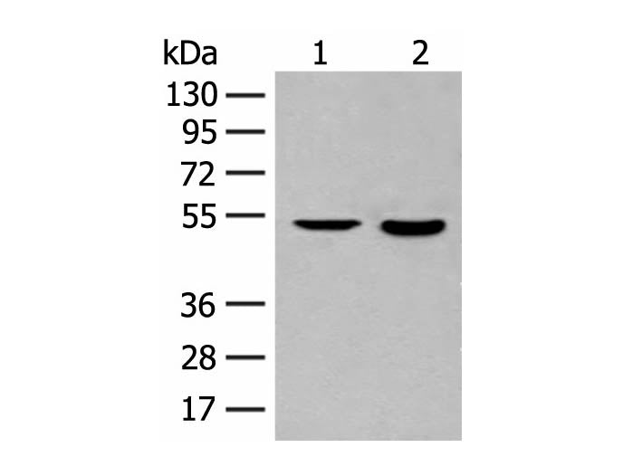 IL7R Polyclonal Antibody