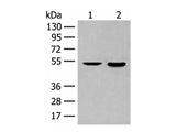 IL7R Polyclonal Antibody