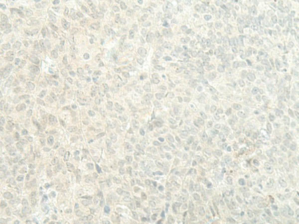 ESRP2 Polyclonal Antibody