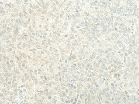 ESRP2 Polyclonal Antibody