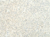 ESRP2 Polyclonal Antibody