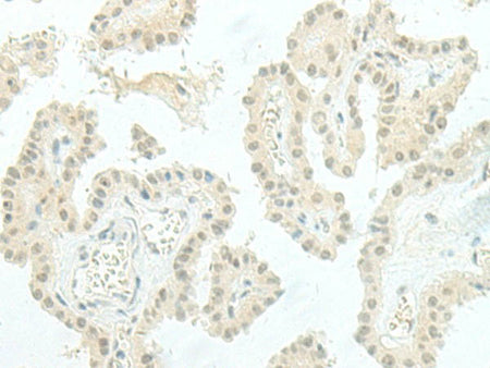 ESRP2 Polyclonal Antibody