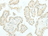 ESRP2 Polyclonal Antibody