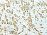 ETAA1 Polyclonal Antibody