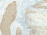ETAA1 Polyclonal Antibody