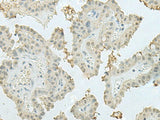 MECOM Polyclonal Antibody