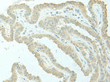 EVI2B Polyclonal Antibody