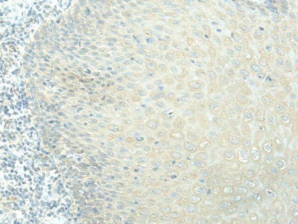 EVI2B Polyclonal Antibody