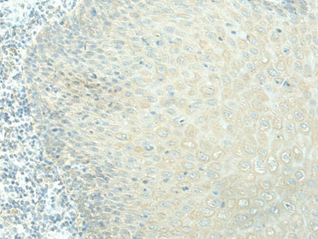 EVI2B Polyclonal Antibody
