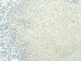 EVI2B Polyclonal Antibody