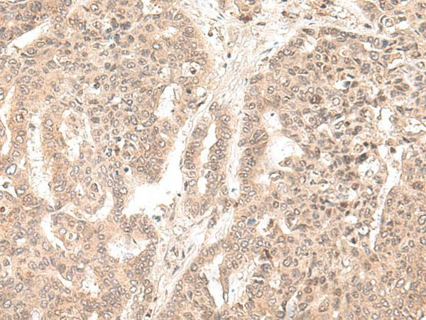 EXOSC9 Polyclonal Antibody