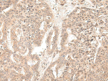 EXOSC9 Polyclonal Antibody