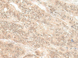 EXOSC9 Polyclonal Antibody