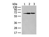 EXOSC9 Polyclonal Antibody