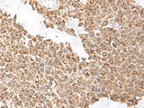 USP16 Polyclonal Antibody
