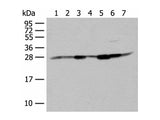 NIPSNAP2 Polyclonal Antibody