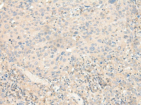 KCNA10 Polyclonal Antibody