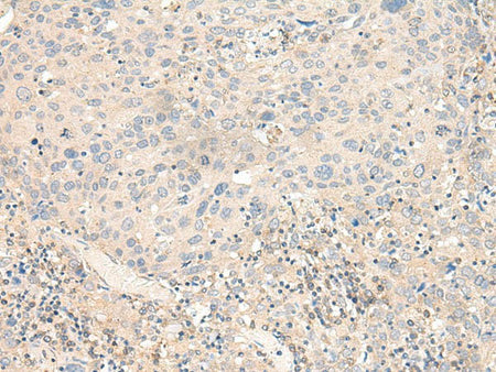 KCNA10 Polyclonal Antibody