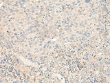 KCNA10 Polyclonal Antibody