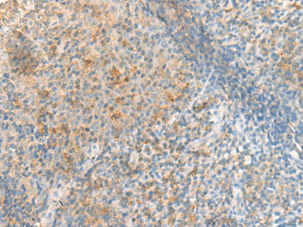 METTL17 Polyclonal Antibody