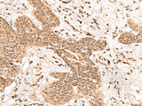 FAM111B Polyclonal Antibody