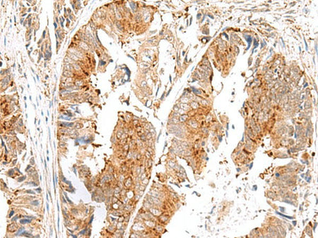 SAXO2 Polyclonal Antibody