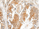 SAXO2 Polyclonal Antibody