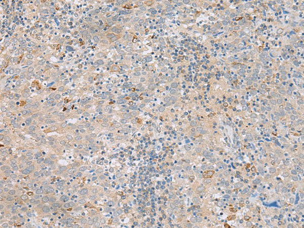 SAXO2 Polyclonal Antibody