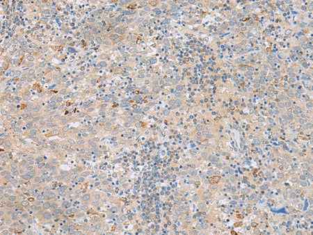 SAXO2 Polyclonal Antibody