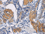 FAM20C Polyclonal Antibody