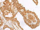 FAM200A Polyclonal Antibody