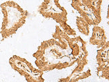 FAM84A Polyclonal Antibody