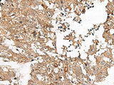 FAM84B Polyclonal Antibody
