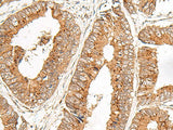 FAM84B Polyclonal Antibody
