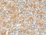 FANCB Polyclonal Antibody