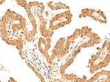 FANCB Polyclonal Antibody