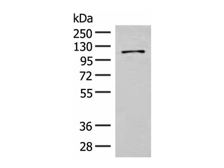 FANCB Polyclonal Antibody
