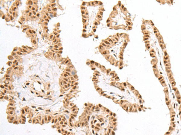 KDM2A Polyclonal Antibody