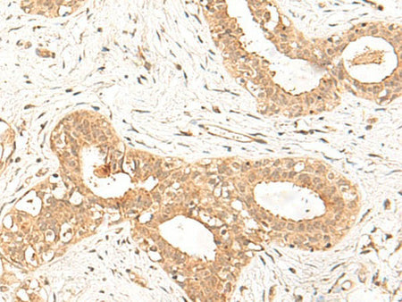 FBXL4 Polyclonal Antibody