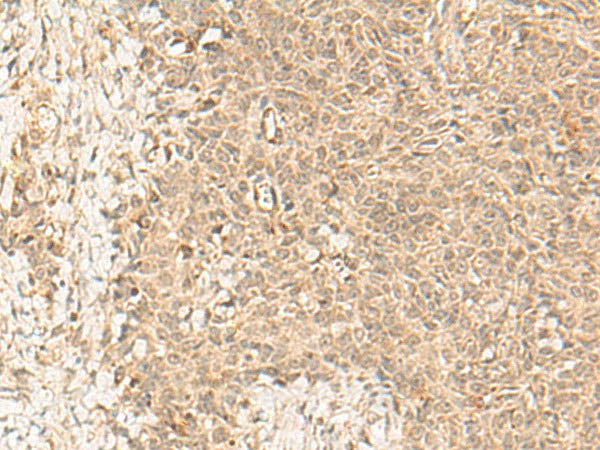 FBXL4 Polyclonal Antibody