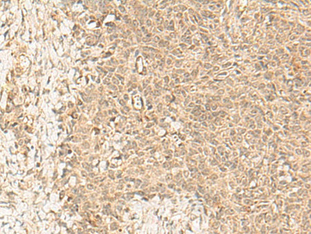 FBXL4 Polyclonal Antibody
