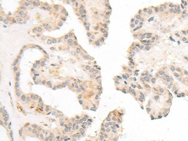 FBXW8 Polyclonal Antibody