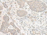 FBXW8 Polyclonal Antibody