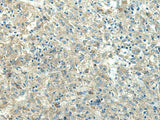 FCGRT Polyclonal Antibody